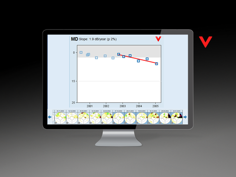 HS_perimetry_ff_xxx_trend_anal